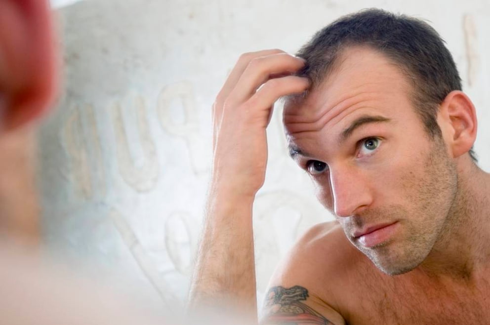 Für geheimratsecken frisur männer mit Frisuren bei