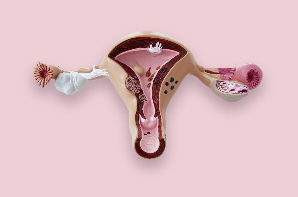 Vasektomie schwanger trotz Möglichkeit